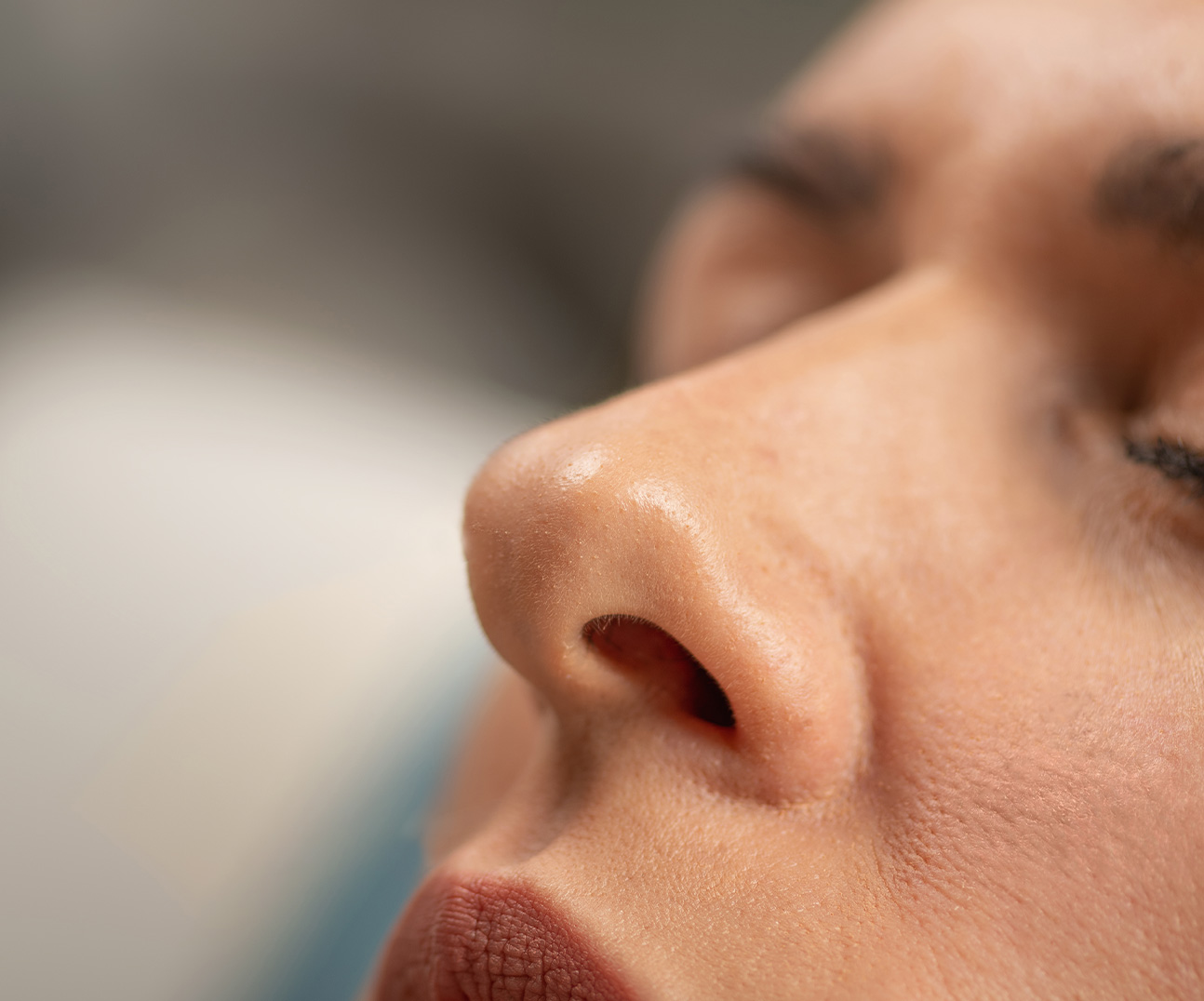 Non-surgical rhinoplasty nose filler procedure